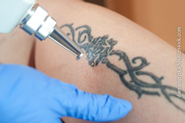 Tattoos: Schönheitsideal mit Risiko