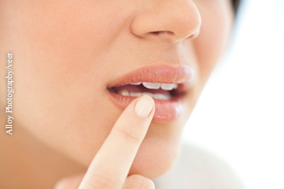 Auf ein Kribbelgefühl am Mund folgt meist ein Herpes-Bläschen.