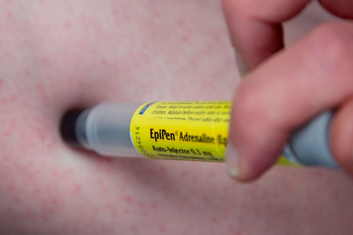 7 Lebensretter bei allergischem Schock